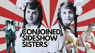 The Bizarre Story of Conjoined Sisters: Daisy and Violet Hilton! #conjoinedtwins #sideshow
