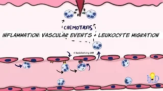 Inflammation: Vascular events and leukocyte migration