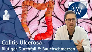 Colitis Ulcerosa: Bauchschmerz & schleimig blutiger Durchfall? Hilfe bei Chronischer Darmerkrankung