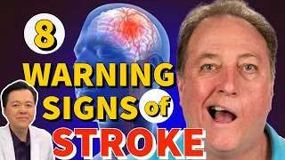 8 Warning Signs for Stroke - Tips by Doc Willie Ong #920b