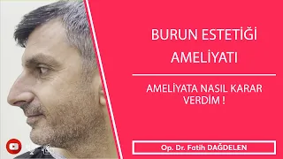 Burun Estetiği Ameliyatına Nasıl Karar Verdim.