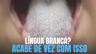 LÍNGUA BRANCA?   SABURRA LINGUAL?    Acabe de vez com isso