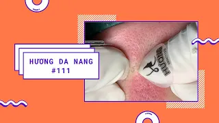 #111 | Huong Da Nang