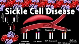 Sickle Cell Disease, Animation