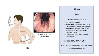 An Approach to GI Bleeding (Melena, Hematemesis, Hematochezia)