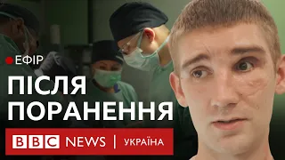 "Операціям немає кінця". Життя військових після поранень | Ефір ВВС