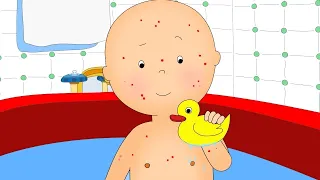 Chicken Pox | Caillou New Adventures | Cartoons for Kids | WildBrain Bananas