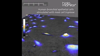 Time-lapse monitoring of human bronchial epithelial cells by Frida Berlin | HoloMonitor®