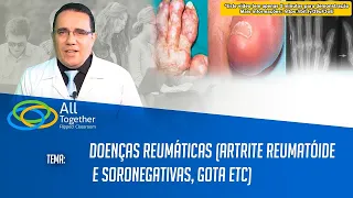 Doenças Reumáticas (Artrite Reumatoide e Soronegativas, Gota ETC)