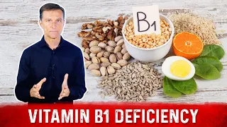 Top Signs and Symptoms of Vitamin B1 Deficiency – Dr. Berg