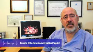 Robotik Safra Kesesi Ameliyatı Nasıl Yapılır? | Prof. Dr. Fatih Ağalar