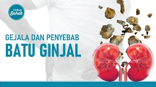 Gejala dan Penyebab Batu Ginjal yang Jarang Disadari | Hidup Sehat tvOne