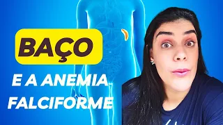 BAÇO e a Anemia Falciforme | asplenia funcional doença falciforme