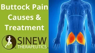 Buttock Pain Causes and Treatment