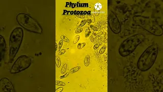 Biology #science #Protozoa #animation #protozoadefine #shorts