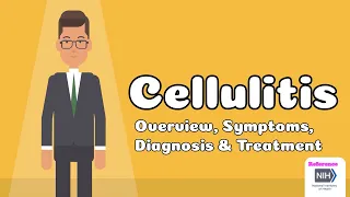 Cellulitis - Overview, Symptoms, Diagnosis & Treatment