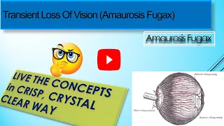 Transient Loss Of Vision (Amaurosis Fugax)