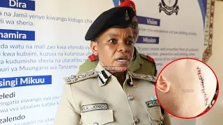 RPC JONGO: UCHUNGUZI WA AWALI UNAONESHA TUKIO LILIPANGWA KUJERUHIWA KWA KAZUNGU MTOTO MWENYE ULEMAVU