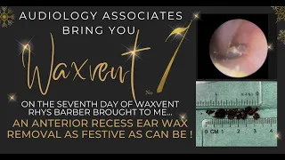 ANTERIOR RECESS EAR WAX REMOVAL - EP526