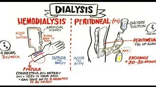 Failing Kidneys and Different Treatment Options