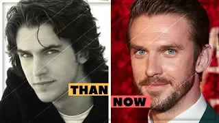 Dan Stevens Amazing Changing Looks | Dan Stevens Transformation