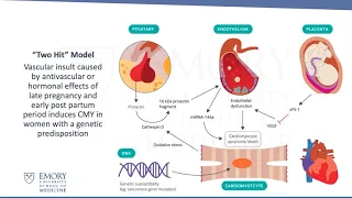 Peripartum Cardiomyopathy