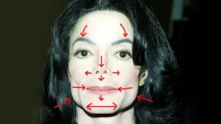 Removing MICHAEL JACKSON'S Plastic Surgery