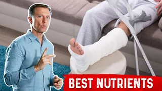 The Best Diet for a Healing Bone: Fracture, Surgery or Trauma