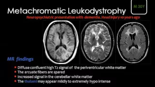 Imaging of White matter diseases I   DRE 10   Dr Mamdouh Mahfouz 720p