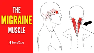 How to Release Tension for FAST MIGRAINE RELIEF