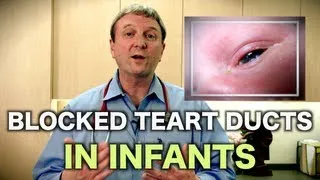 Blocked Tear Ducts in Infants (Pediatric Advice)