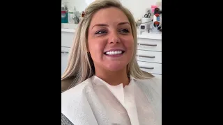 Rhanne's review of Zirconium Crowns and Before & After! 🦷