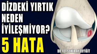 DİZDEKİ YIRTIĞIN İYİLEŞMEMESİNE NEDEN OLAN 5 HATA #aktifizyo #dizağrısı #menisküs