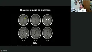 Вебинар МРО РОРР: МРТ- диагностика при рассеянном склерозе в дебюте и в динамике