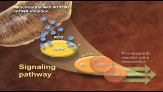 Research on the causes of mitochodrial deafness