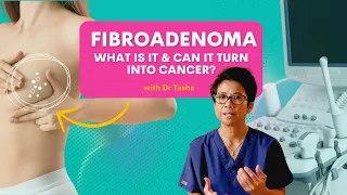 Understanding Fibroadenomas: Can it turn to cancer? - with Dr Tasha