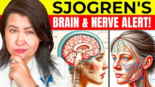 How Sjogren's Can Influence Your Brain and Nerves