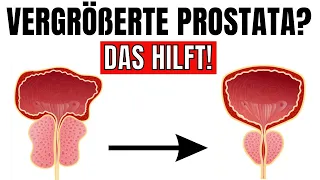 Der wichtigste Nährstoff, um deine Prostata zu verkleinern