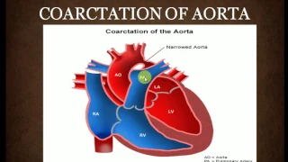 CONGENITAL HEART DISEASE , Part 1 , PAEDIATRICS LECTURES , INTRODUCTION