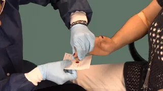 ISDH Phlebotomy: How to Perform a Fingerstick Procedure