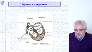 Желудочковые нарушения ритма, желудочковые тахикардии и внезапная сердечная смерть   Санкт Петербург