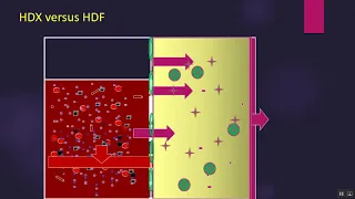 Prof. Hesham Elsayed : HDX versus HDF part 1