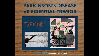 Parkinson's Disease vs Essential Tremor