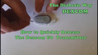 How to Remove The Dexcom G6 Transmitter