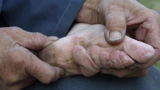 Chinese Foot Binding