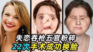 换脸手术有多恐怖？18岁女孩毁容，换上31岁女人的脸