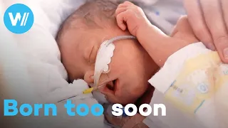 Born two months early, baby twins are battling for their lives - Premature babies' first days