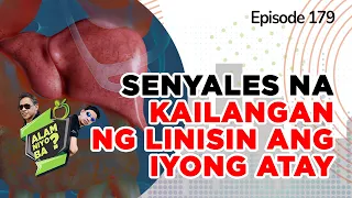 Alam Niyo Ba? Episode 179 | Signs that you Need to Cleanse Your Liver