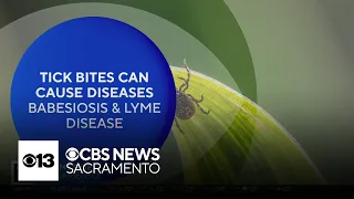 The Answer: Tick season safety?