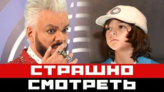 Прижало машиной: Киркоров в Сочи, страшно смотреть